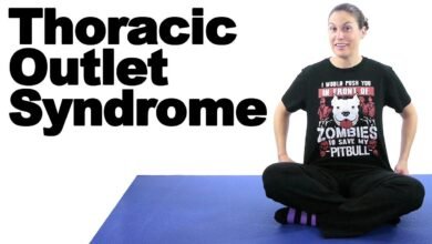 Top Thoracic Outlet Syndrome Exercises for Pain Relief