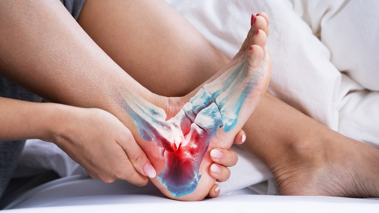 10 Tips for Fast Recovery from Ripped Plantar Fasciitis