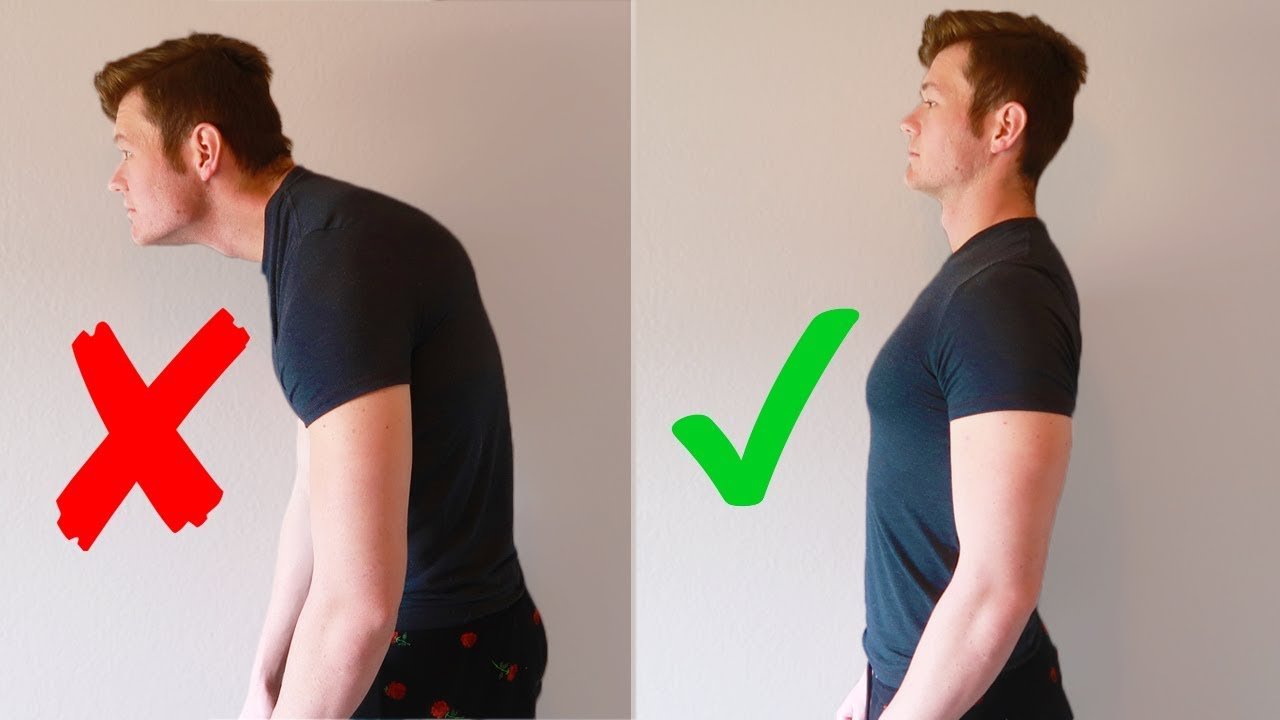 Relieve Tech Neck Exercises | Simple Daily Exercises