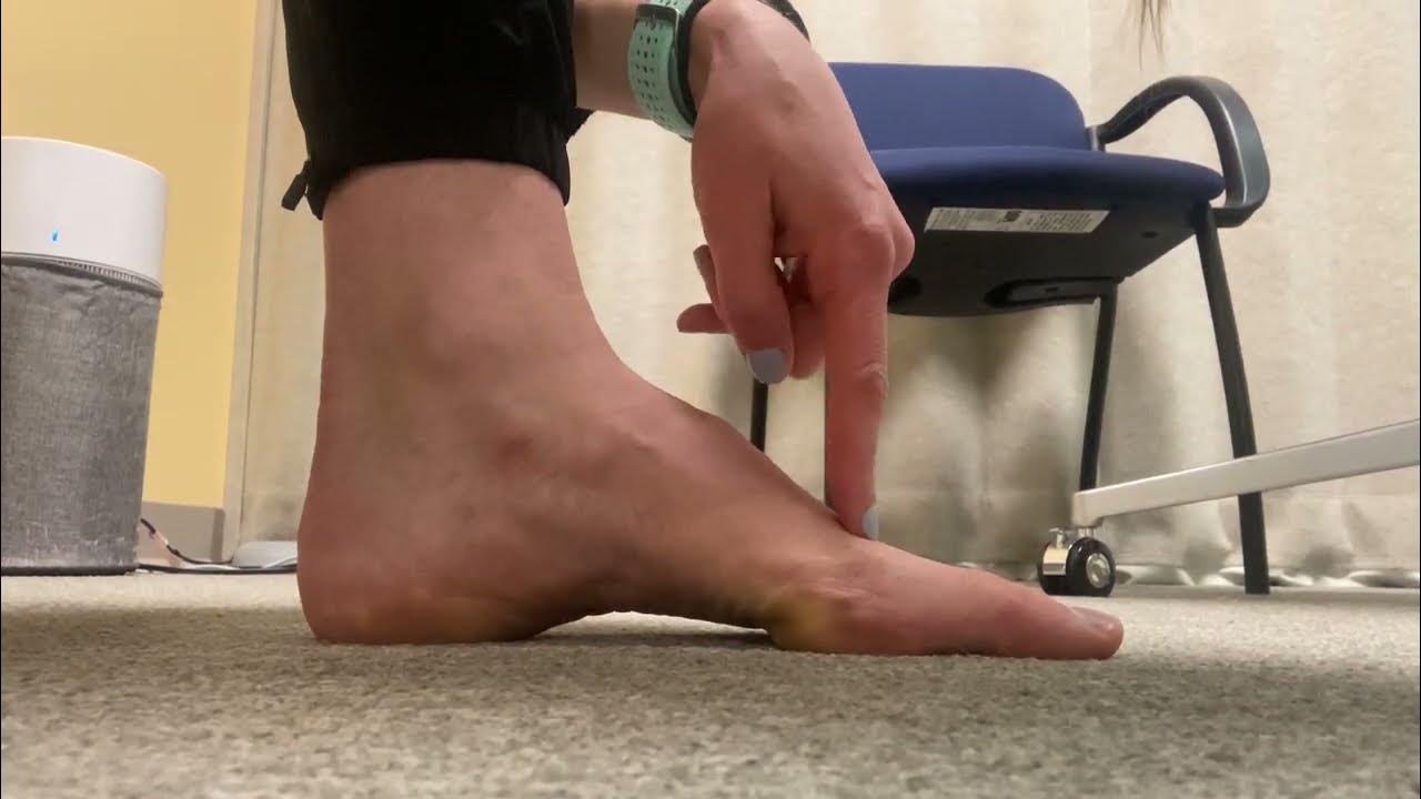 Best Hammer Toe Exercises: Top 10 Solutions for Relief